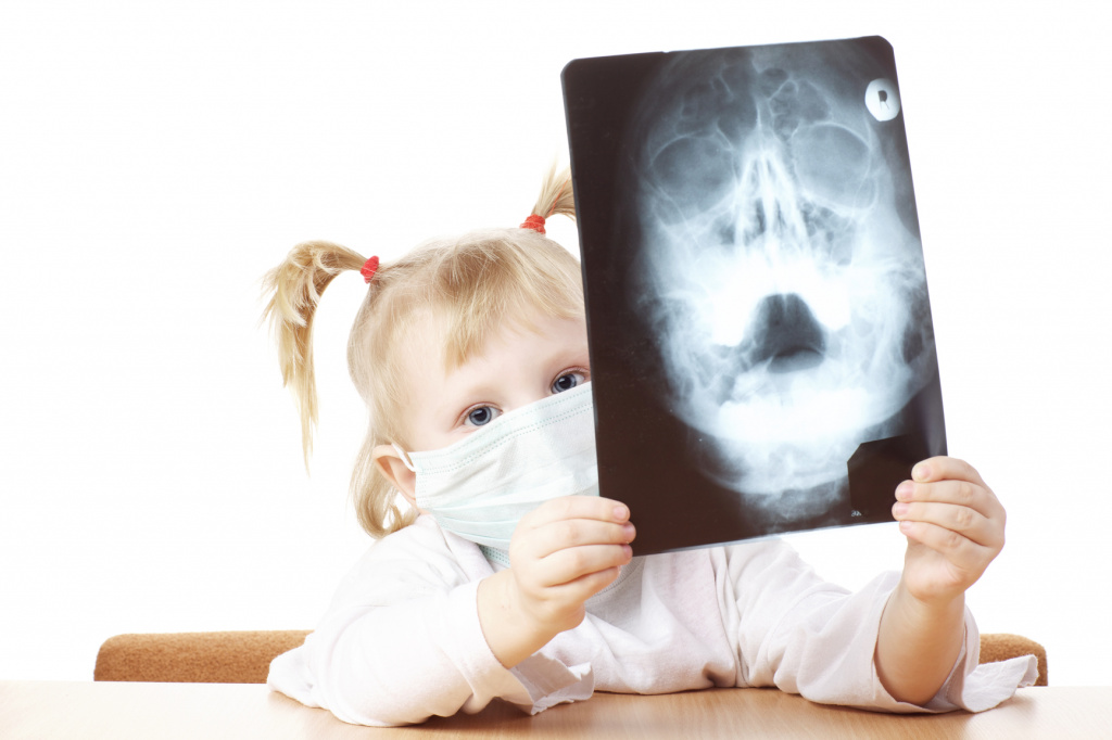 Можно ли делать рентген носа при температуре у ребенка thumbnail